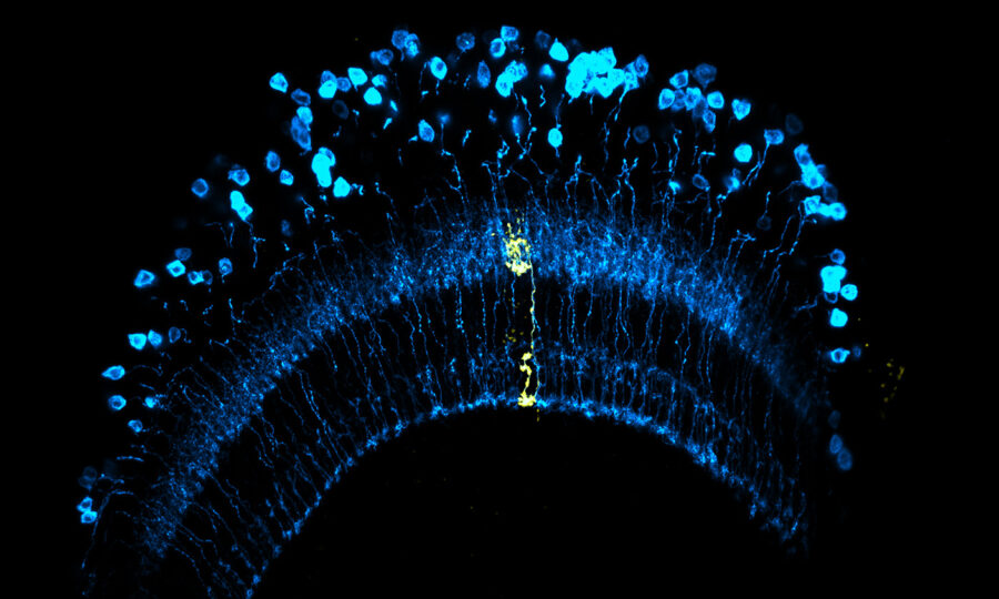 Mikroskopische Aufnahme einer gebogenen Struktur mit blau und gelb leuchtenden neuronenähnlichen Zellen, die die Nervenbahnen vor einem schwarzen Hintergrund hervorheben.