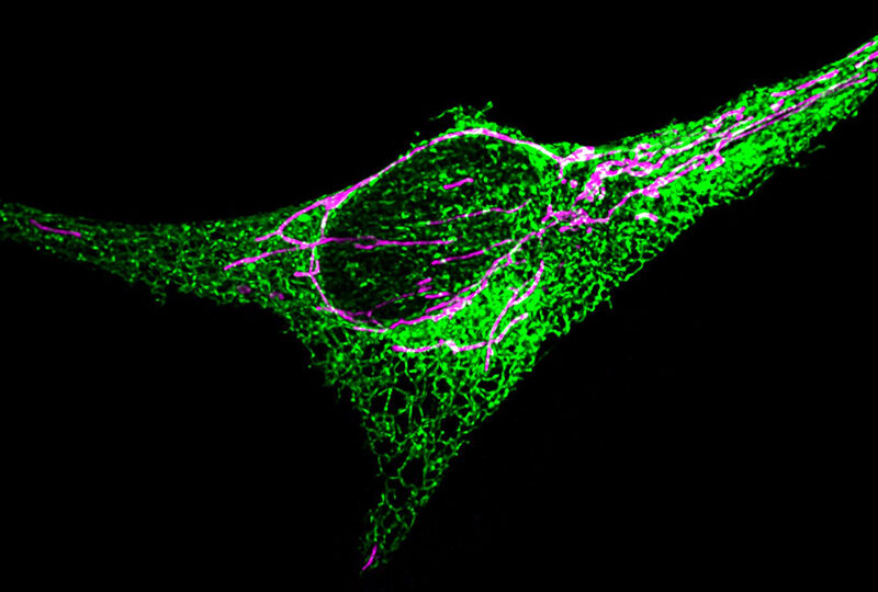 Fluoreszenzmikroskopische Aufnahme einer einzelnen Zelle mit grün und violett hervorgehobenen Strukturen, die einen großen zentralen Zellkern und ein netzartiges Netz von Filamenten auf schwarzem Hintergrund zeigen.
