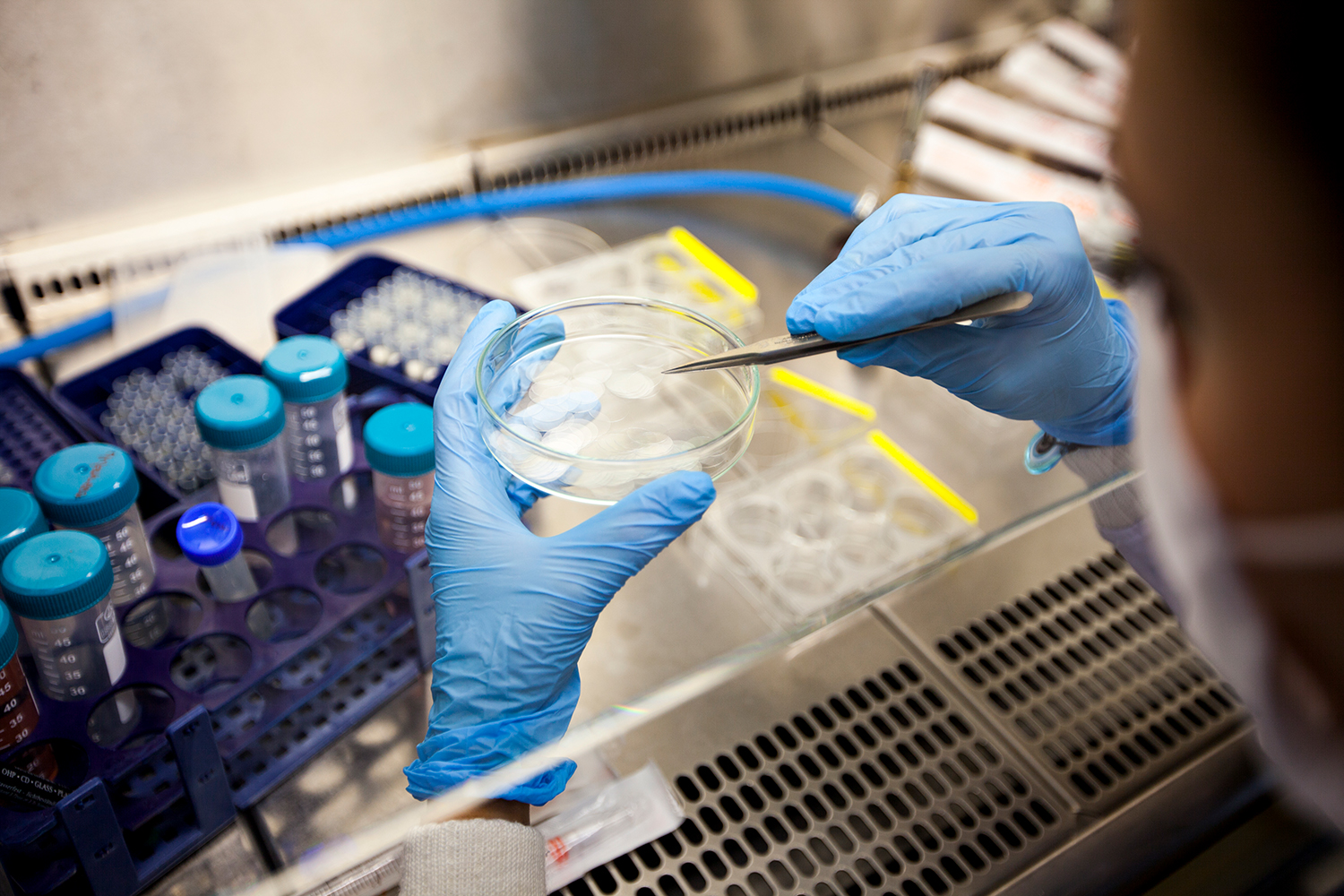 Eine Person mit blauen Handschuhen benutzt eine Pinzette, um eine Petrischale in einem Labor zu bearbeiten. Reagenzgläser und Laborgeräte sind auf der Arbeitsfläche zu sehen.